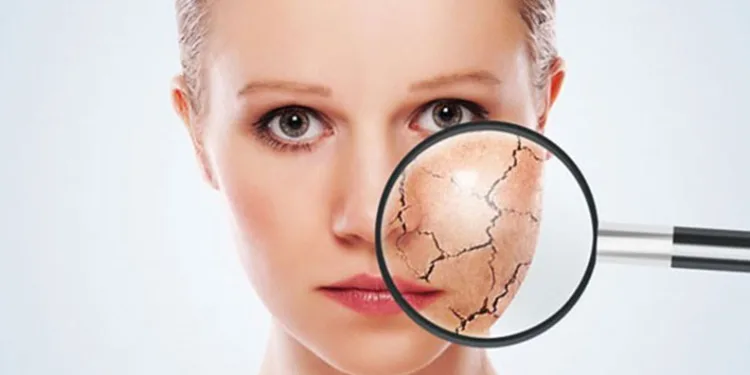 Cildiniz için kışa hazırlık reçetesi