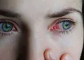 Kışın göz enfeksiyonlarına dikkat