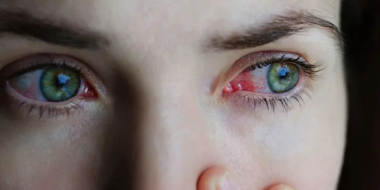 Kışın göz enfeksiyonlarına dikkat