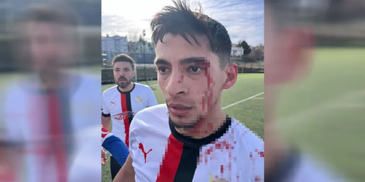 Maç sonrası saha içi savaş alanına döndü